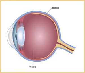 tratamento de doenças de retina em curitiba