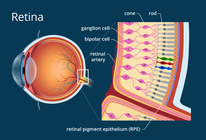 doenças frequentes de retina em curitiba