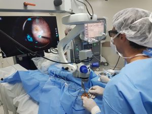 O Dr. Alexandre Grandinetti, especialista em retina e vítreo, passou a utilizar o equipamento NGENUITY®, que permite a visualização 3D com profundidade dos tecidos oculares para cirurgias de Retina e Catarata, facilitando a observação de detalhes importantes do olho e tornando a cirurgia ainda mais segura. Dr. Alexandre relata que o NGENUITY® 3D é um equipamento que está revolucionando a qualidade na imagem, profundidade de campo e a ergonomia para o cirurgião durante o procedimento. Todos esses fatores combinados resultam em uma precisão cirúrgica nunca visto antes na oftalmologia. O médico explica que as cirurgias de retina, antes dos equipamentos com visualização 3D, eram realizadas com uma visão bidimensional, o que dificultava a ação do médico, pois a percepção de profundidade exigia muito conhecimento teórico e prático. Já a visualização 3D proporcionada pelo NGENUITY permite identificar detalhes com muito mais facilidade e clareza. Com essa nova tecnologia, as cirurgias de retina e catarata alcançam mais segurança e melhores resultados.