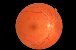 Conheça as principais doenças que podem ser tratadas em Curitiba e o valor para tratamentos de retina