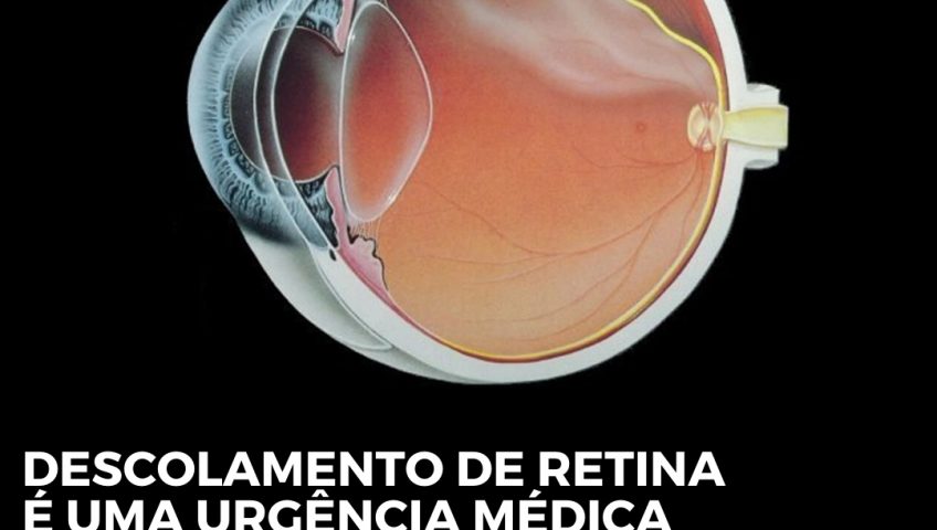 O descolamento de retina é considerado caso de urgência! - NeoOftalmo