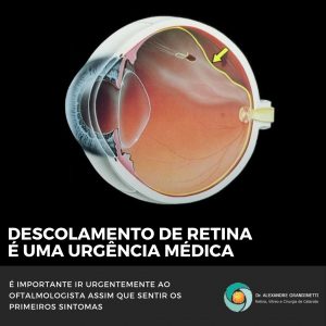 descolamento de retina é uma urgência médica