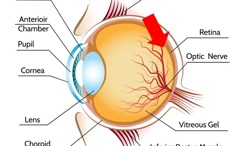 degeneração macular de retina dmri tratamento curitiba
