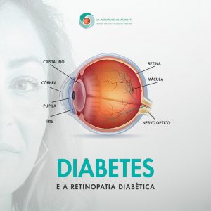 Tratamento da Retinopatia Diabética em Curitiba
