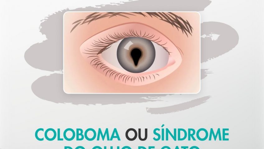 Tratamento de Coloboma em Curitiba - Síndrome de Olho de Gato