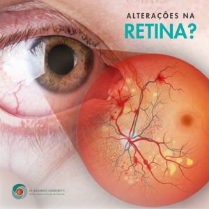 Especialista em Alterações na Retina em Curitiba
