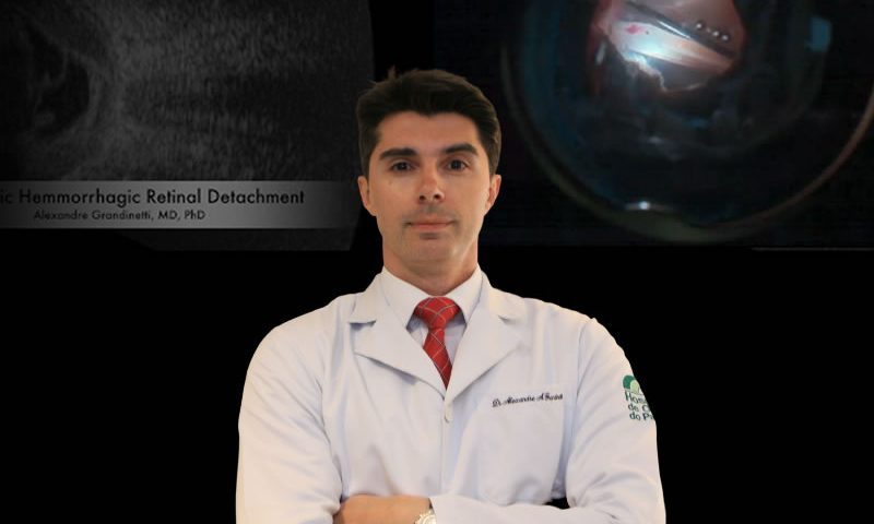 dr alexandre grantinetti retinólogo especialista em retina e catarata em curitiba