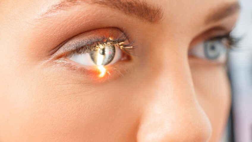 cirurgia de retina fotocoagulação a laser em curitiba