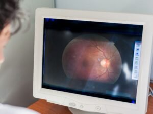 Esperança na Visão A Revolução das Cirurgias Oftalmológicas em Pacientes com Diabetes