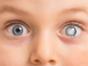 O que é a Doença de Coats e Por Que é Tão Perigosa