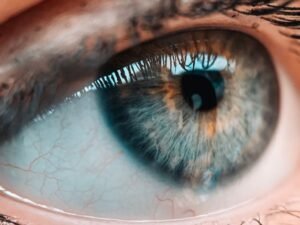 Angiografia digital de retina Curitiba