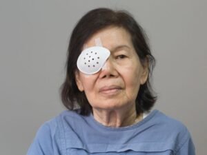 Guia completo para o pós-operatório de catarata em Curitiba