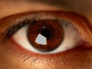 Pós-operatório da Cirurgia de Retina em Curitiba Guia de Cuidados e Recuperação