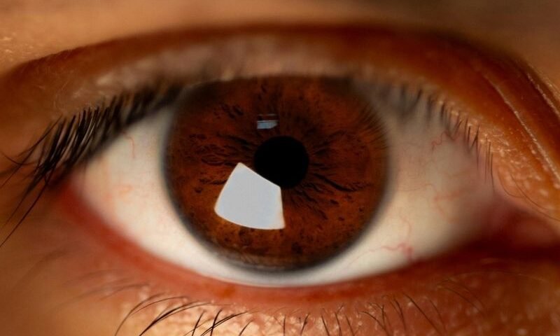 Pós-operatório da Cirurgia de Retina em Curitiba Guia de Cuidados e Recuperação