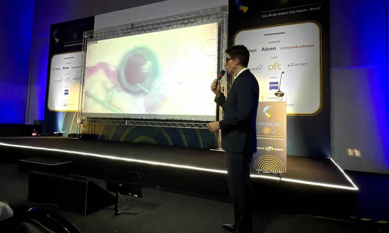 Dr. Alexandre Grandinetti apresenta caso de catarata pediátrica no Congresso Brasileiro de Catarata e Cirurgia Refrativa